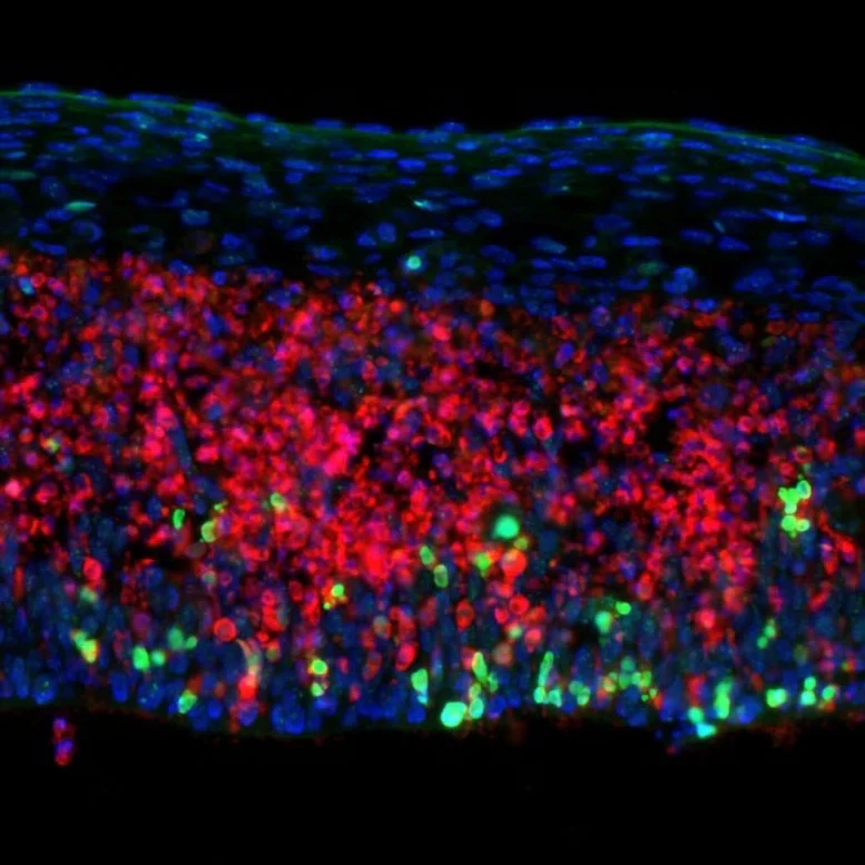 MS‘te nöron kaybının sırrı çözüldü: Tedavide DNA onarımı umudu