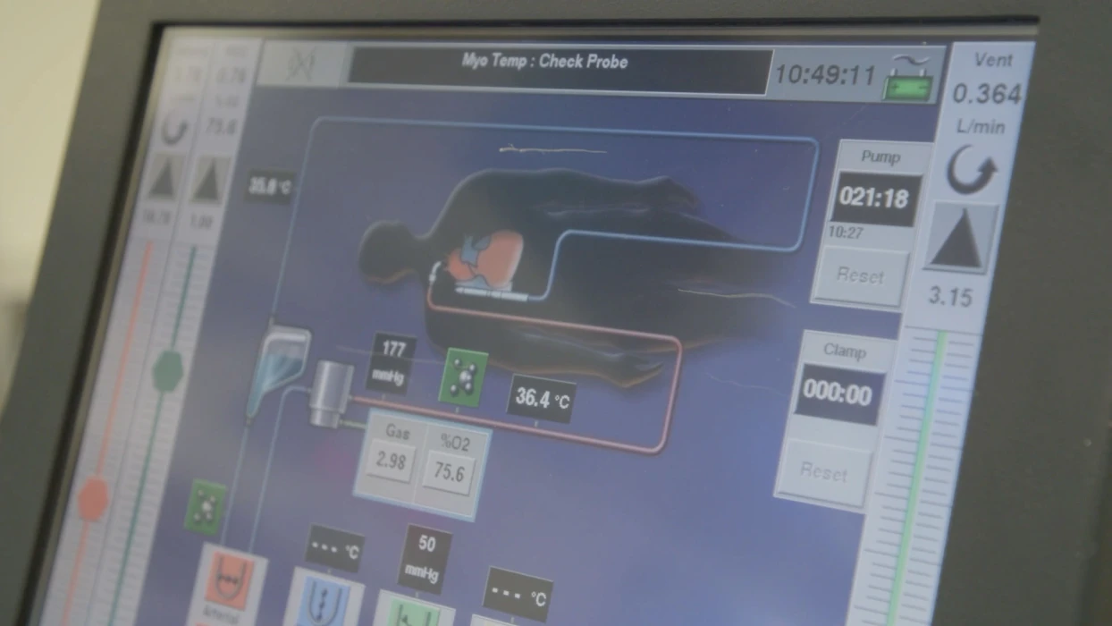 Akciğersiz yaşatan yapay sistemle hayat kurtuldu