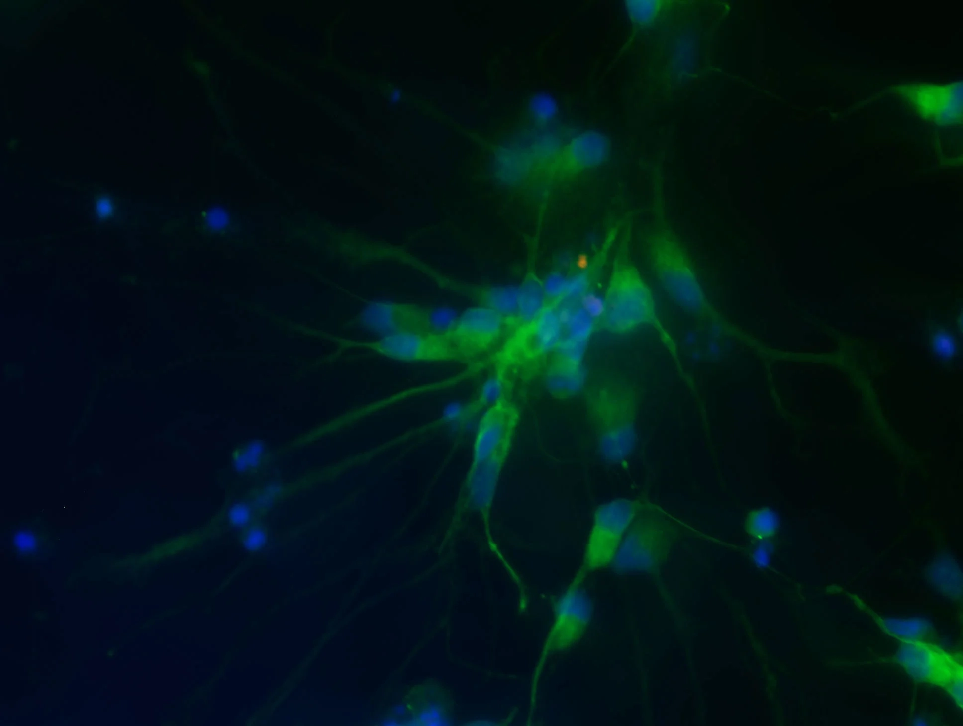 Yaşlanma ve beyin hastalıkları arasındaki ‘moleküler köprü’ çözüldü