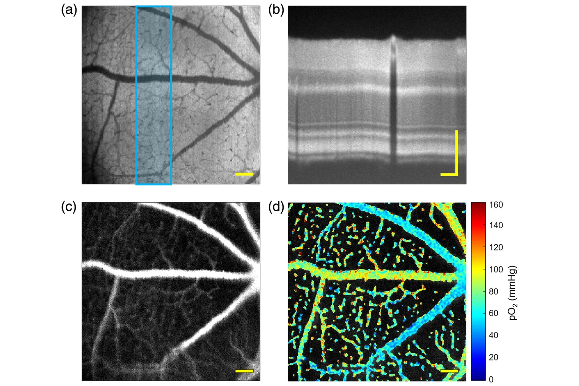 Retina tanısında erken teşhis: Yeni çift kanallı görüntüleme