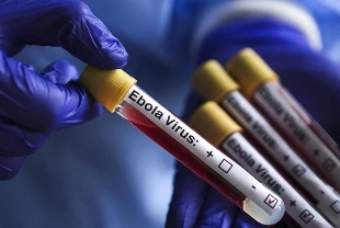 DSÖ’den Ebola salgını açıklaması: Seyahat ve ticaret kısıtlaması önerilmiyor