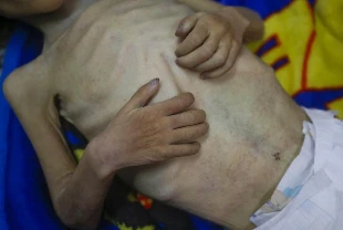 Gazze'de son 24 saatte 2'si çocuk 6 kişi daha açlıktan hayatını kaybetti