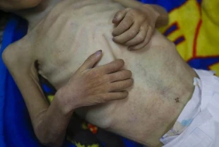 Gazze'de son 24 saatte 5 kişi daha açlıktan hayatını kaybetti