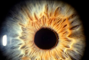 Görme kaybında yeni dönem: Retina nakli için kritik eşik aşıldı