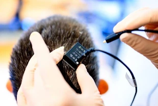 Hasta yapay zeka destekli beyin implantıyla 18 yıl sonra yeniden konuştu