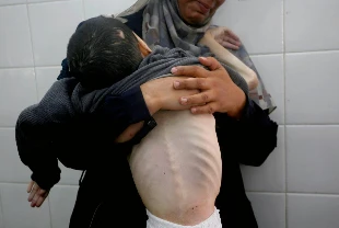 İsrail'in kıtlığı dayattığı Gazze'de 4 kişi daha açlıktan hayatını kaybetti