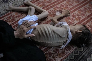 İsrail'in kıtlığı dayattığı Gazze'de son 24 saatte 2'si çocuk 7 Filistinli daha açlıktan hayatını kaybetti