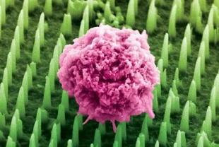 Nanoteknolojiyle ağrısız biyopsi dönemi başlıyor