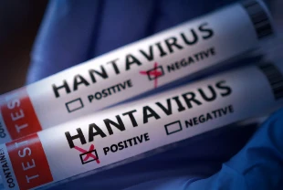 Sağlık Bakanlığından 'hantavirüs' açıklaması: Türk vatandaşların test sonuçları negatif