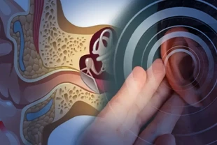 Uzmanlar açıkladı! Meniere hastalığında erken teşhis kalıcı hasarları önlüyor