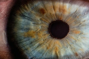 Yapay retina implantı kör gözlere görme yetisi kazandırıyor