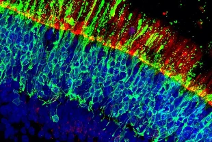 Yaşa bağlı görme kaybına karşı genetik buluş