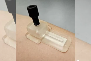 Yeni mikroiğneli yama kan almadan sağlık takibi sağlıyor