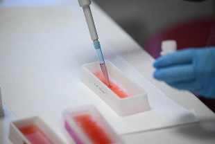 Yeni tip şapa karşı 15 milyon doz aşı sahaya sevk edilecek