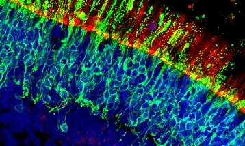 Yaşa bağlı görme kaybına karşı genetik buluş