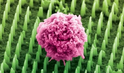 Nanoteknolojiyle ağrısız biyopsi dönemi başlıyor
