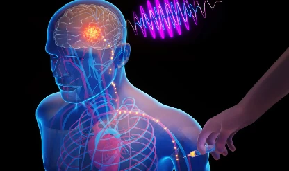 Neştersiz beyin ameliyatı: ‘Sirkülatronikler’, kablosuz implant