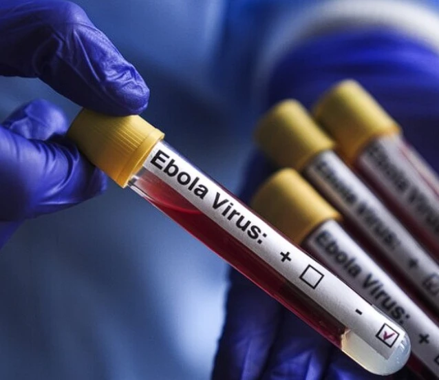 DSÖ’den Ebola salgını açıklaması: Ticaret kısıtlaması önerilmiyor