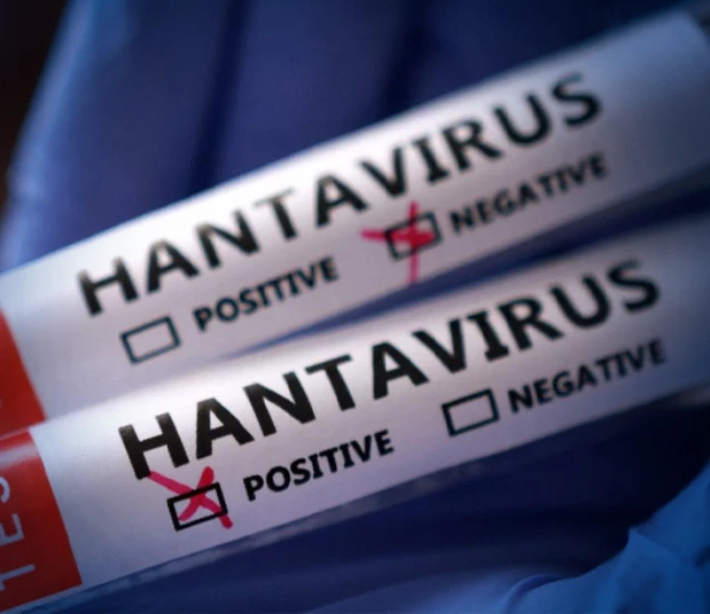 Sağlık Bakanlığından 'hantavirüs' açıklaması: Türk vatandaşların test sonuçları negatif