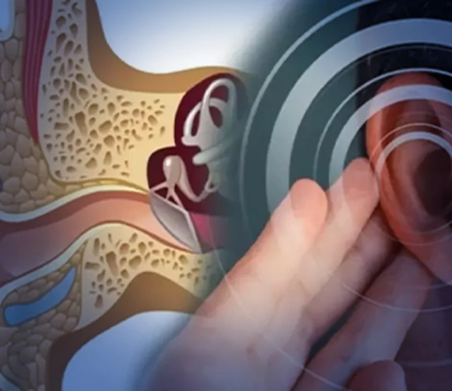 Meniere hastalığında erken teşhis kalıcı hasarları önlüyor