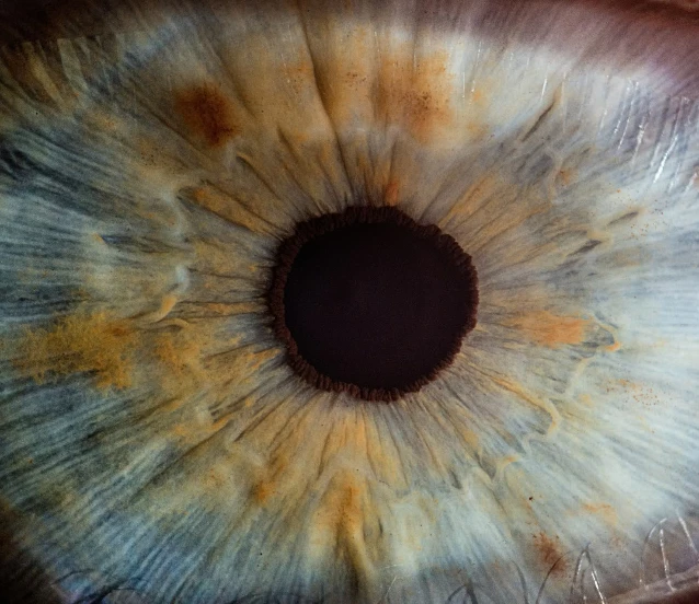 Yapay retina implantı kör gözlere görme yetisi kazandırıyor