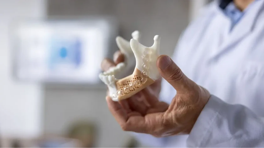 3B yazdırılabilir biyo-cam, kemik ikamesinde çıtayı yükseltiyor