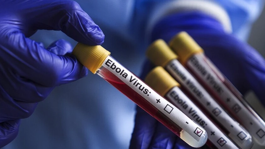 DSÖ’den Ebola salgını açıklaması: Seyahat ve ticaret kısıtlaması önerilmiyor