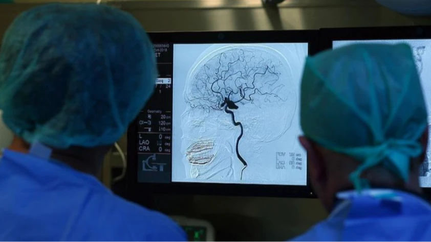 İngiltere’de Huntington hastalığı için ilk tedavi geliştirildi İngiltere’de Huntington hastalığı için ilk tedavi geliştirildi