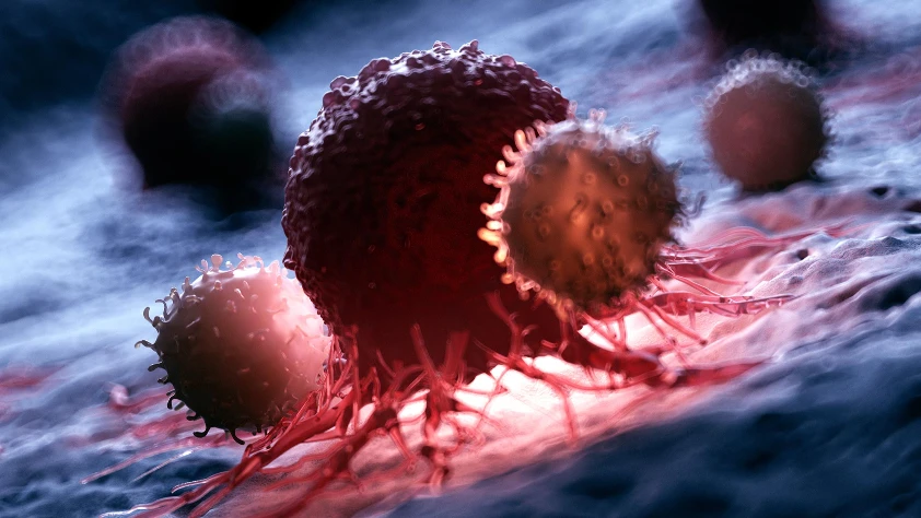 Kanser öldürücü T hücrelerini uyandırmanın yeni bir yolunu bulundu