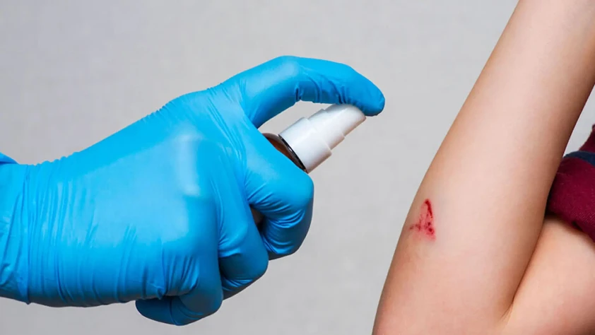 Kore’den tıbbi teknolojide yeni eşik: Kanamayı anında durduran sprey