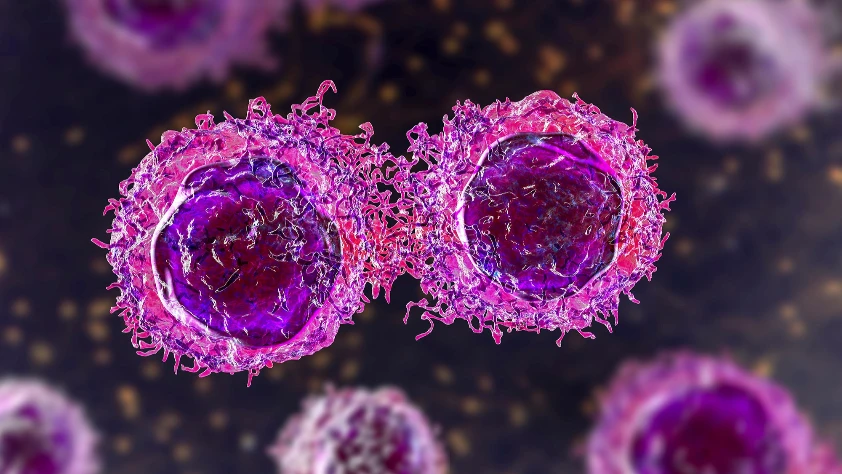 Lösemide üçlü tedavi başarısı: Bağışıklık sistemi yeniden programlandı Lösemide üçlü tedavi başarısı: Bağışıklık sistemi yeniden programlandı