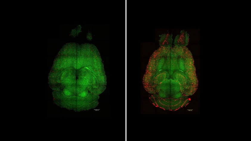 Nanopartikül ‘anahtar’, BBB’yi onarıp Alzheimer’ı geriye çevirdi