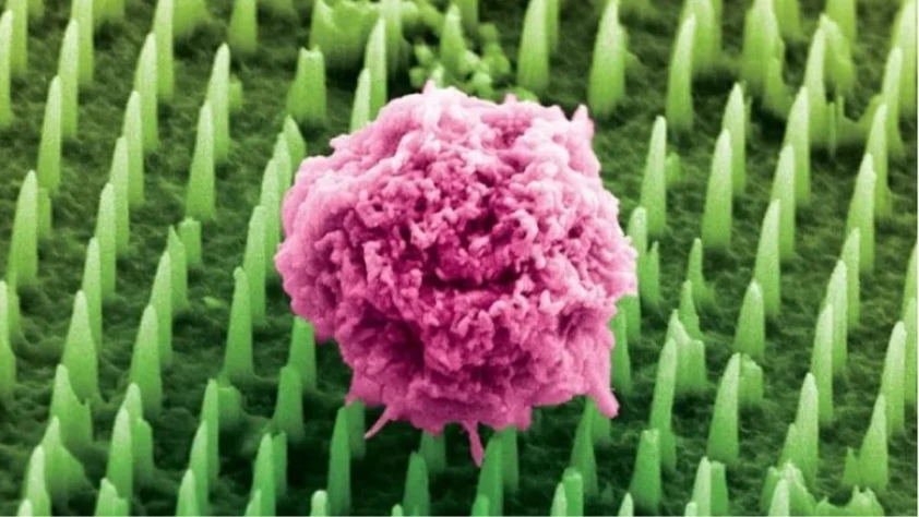 Nanoteknolojiyle ağrısız biyopsi dönemi başlıyor