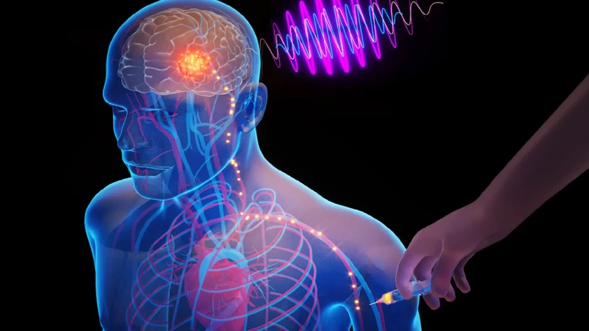 Neştersiz beyin ameliyatı: ‘Sirkülatronikler’, kablosuz implant