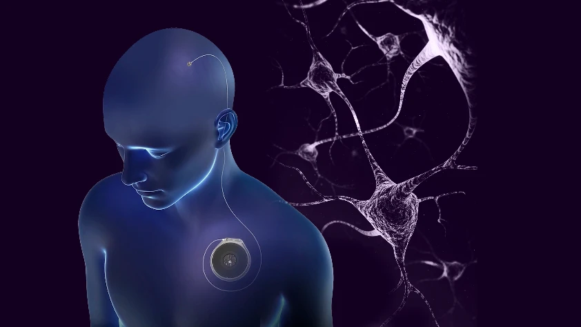 Neuralink'e rakip: Paradromics ilk insan testini gerçekleştirdi