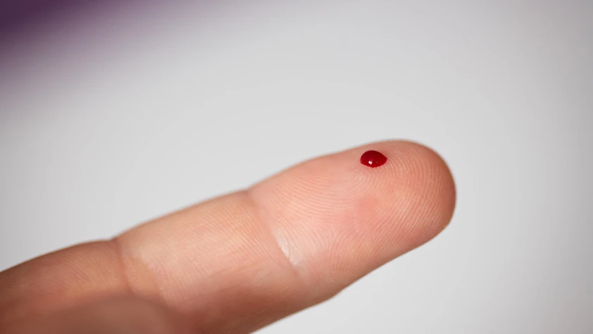 Rutin kan testiyle kansere erken teşhis imkanı