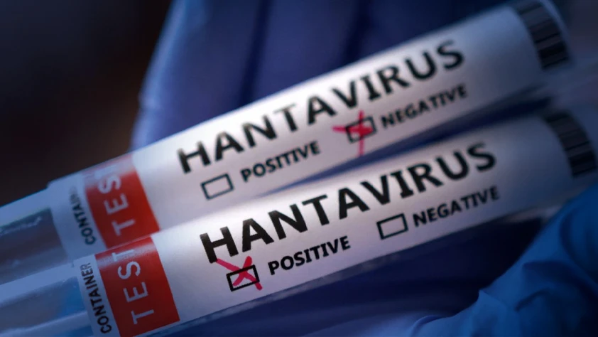 Sağlık Bakanlığından 'hantavirüs' açıklaması: Türk vatandaşların test sonuçları negatif