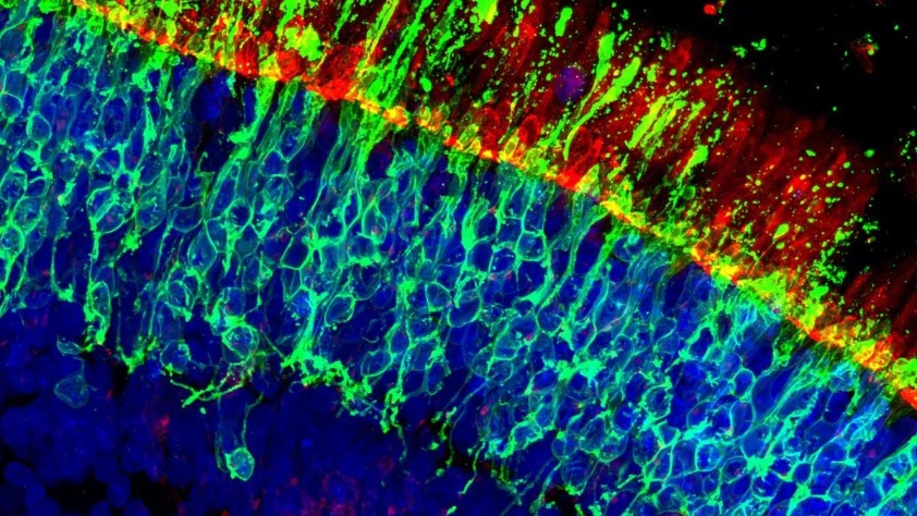 Yaşa bağlı görme kaybına karşı genetik buluş