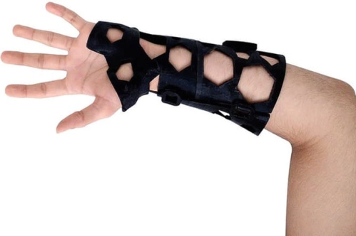 Kemik kırıklarına 3D tedavi Kemik kırıklarına 3D tedavi
