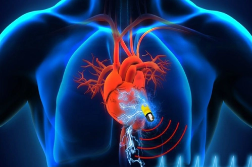 Pilsiz implantlar yolda Pilsiz implantlar yolda