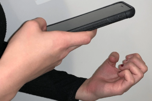 Cep telefonu ile kansızlık testi Cep telefonu ile kansızlık testi