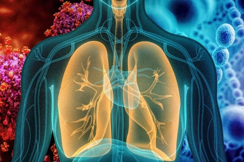 Zatürre enfeksiyonlarını nano-sensörler ayırt edecek Zatürre enfeksiyonlarını nano-sensörler ayırt edecek