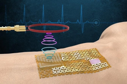 Çipsiz ve kablosuz elektronik ‘kaplama’ üretildi Çipsiz ve kablosuz elektronik ‘kaplama’ üretildi