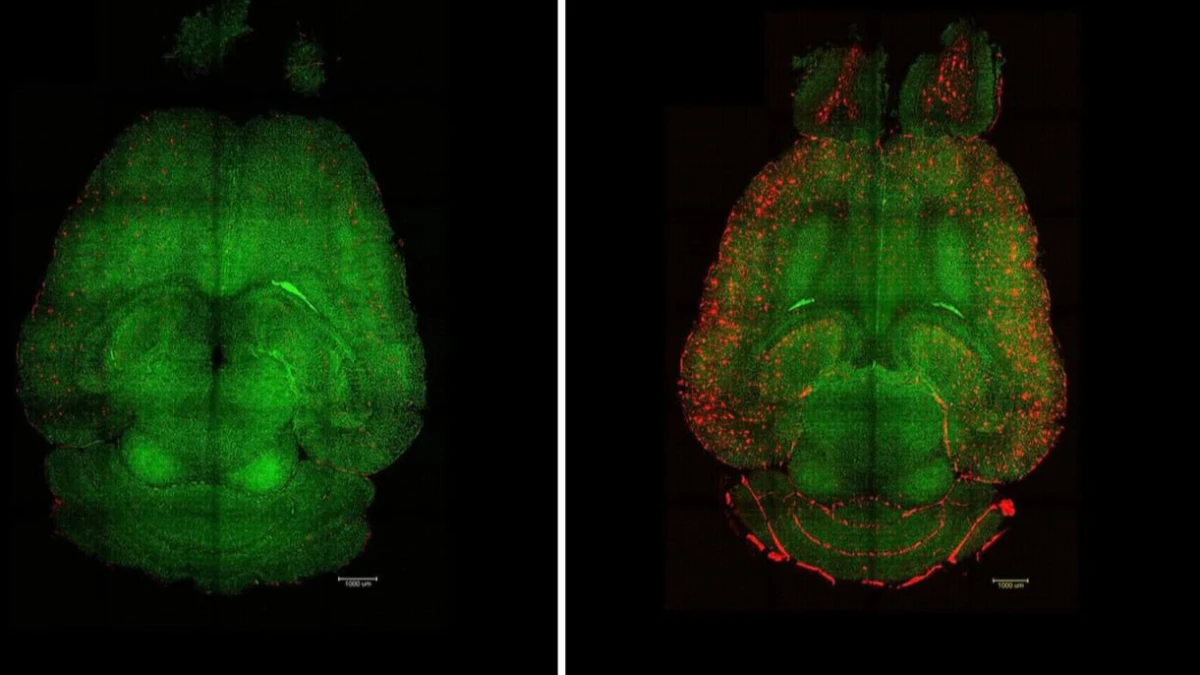 Nanopartikül ‘anahtar’, BBB’yi onarıp Alzheimer’ı geriye çevirdi Nanopartikül ‘anahtar’, BBB’yi onarıp Alzheimer’ı geriye çevirdi