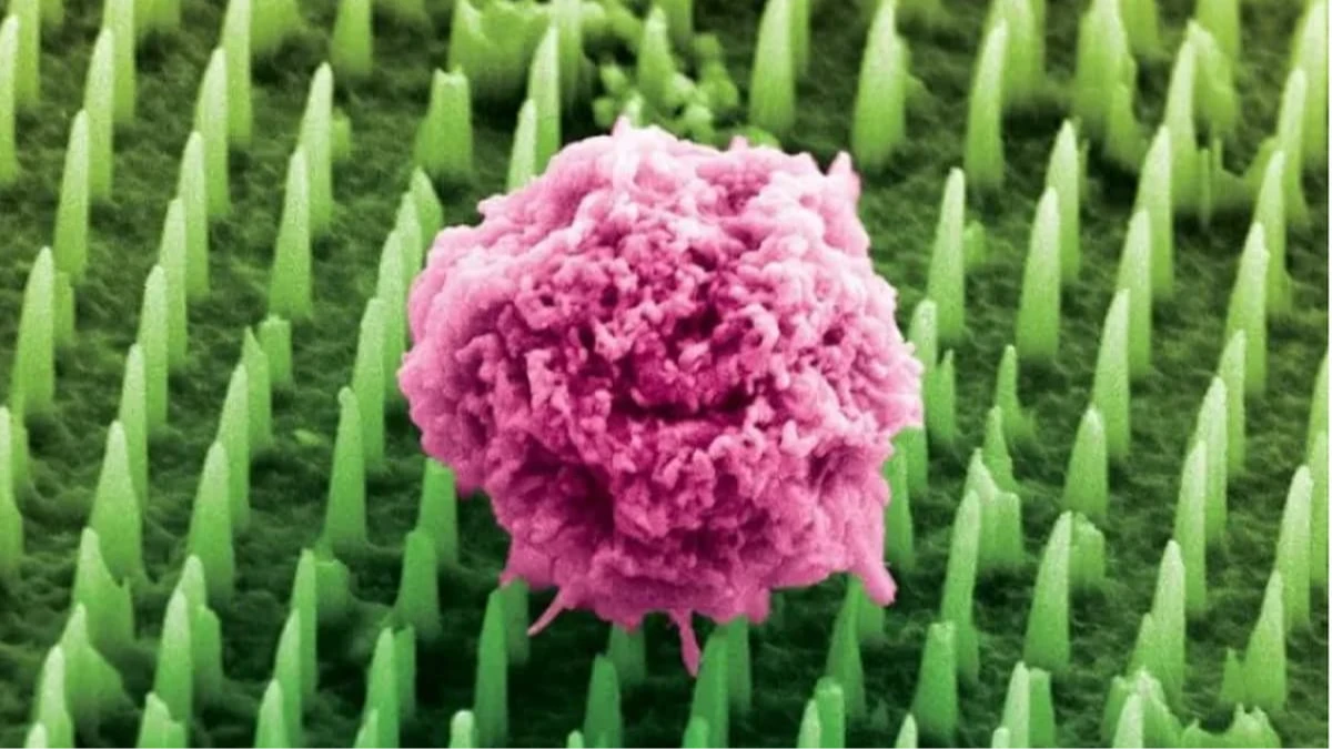 Nanoteknolojiyle ağrısız biyopsi dönemi başlıyor Nanoteknolojiyle ağrısız biyopsi dönemi başlıyor