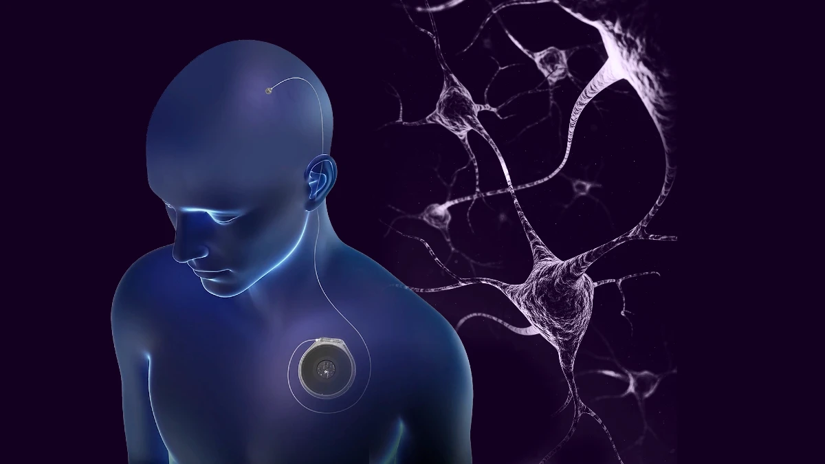 Neuralink'e rakip: Paradromics ilk insan testini gerçekleştirdi Neuralink'e rakip: Paradromics ilk insan testini gerçekleştirdi