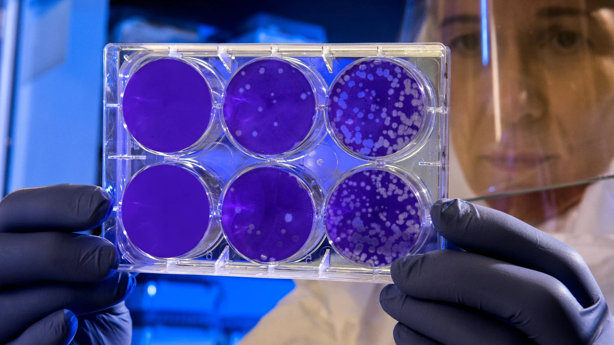 Uyanmayan bakteri: NASA 'ölü taklidi yapan' yeni bir bakteri keşfetti Uyanmayan bakteri: NASA 'ölü taklidi yapan' yeni bir bakteri keşfetti